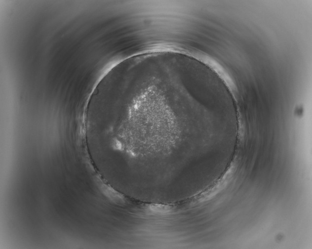 X0000101981097200808151355