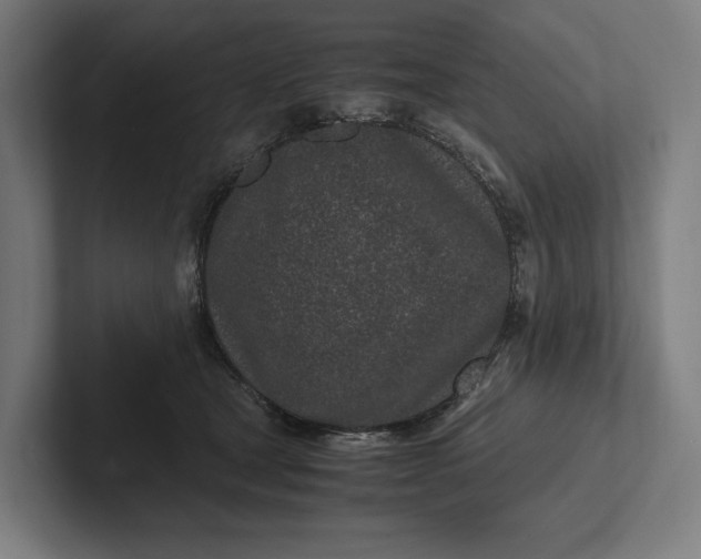 X0000101990465200808011105