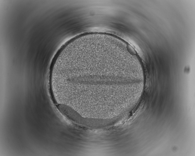 X0000101990992200808151420