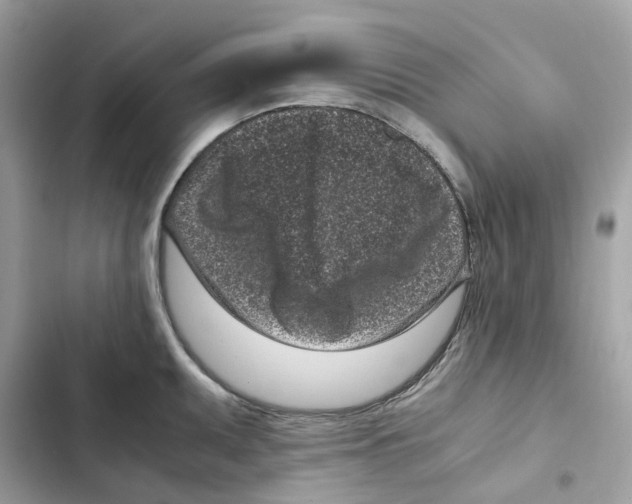 X0000101991095200808151418