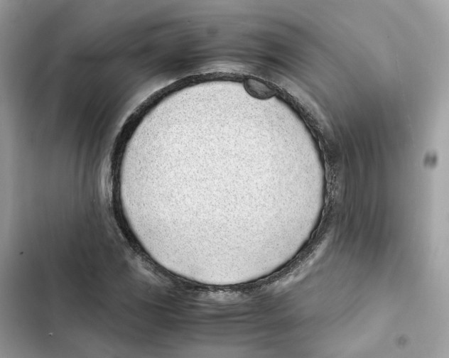 X0000101991117200808151417