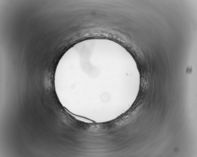 X0000101991490200808151412