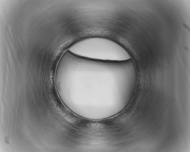 X0000102000590200807180850