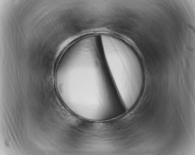 X0000102001176200807180842
