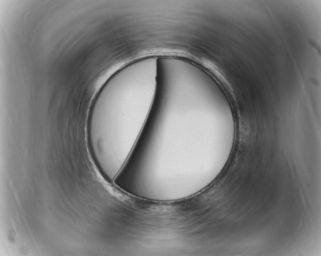 X0000102001237200807180841