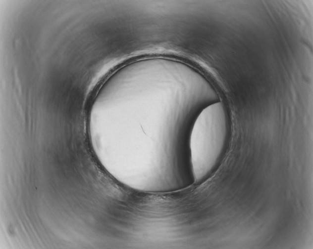 X0000102001270200807180840
