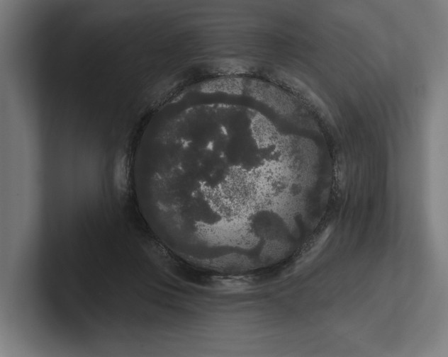 X0000102000359200808011126