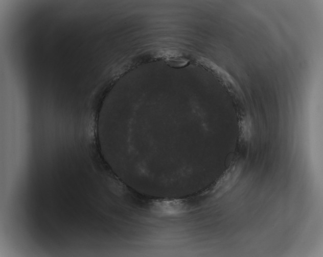 X0000102000517200808011124