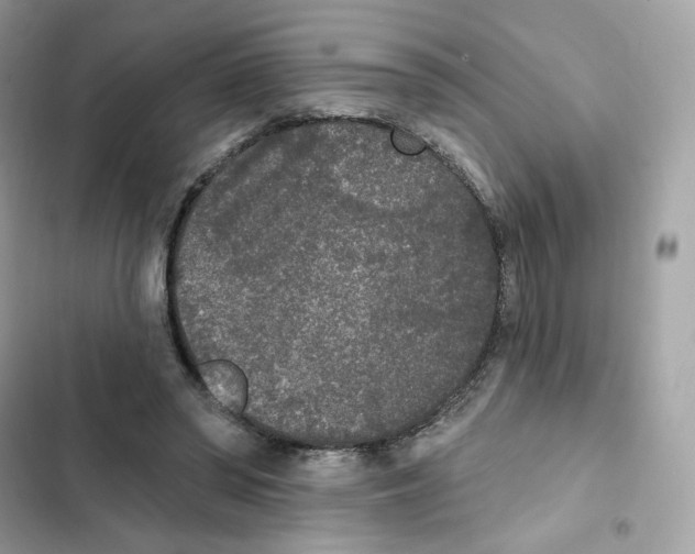 X0000102000398200808151452