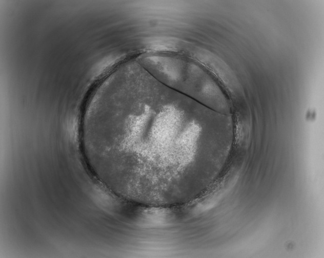 X0000102000444200808151451