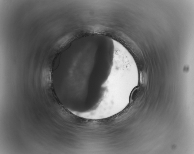 X0000102001155200808151440