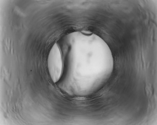 X0000102010085200807180920