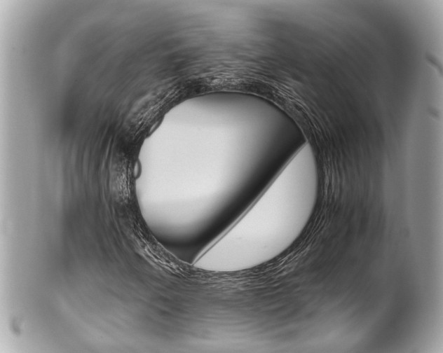 X0000102011250200807180903