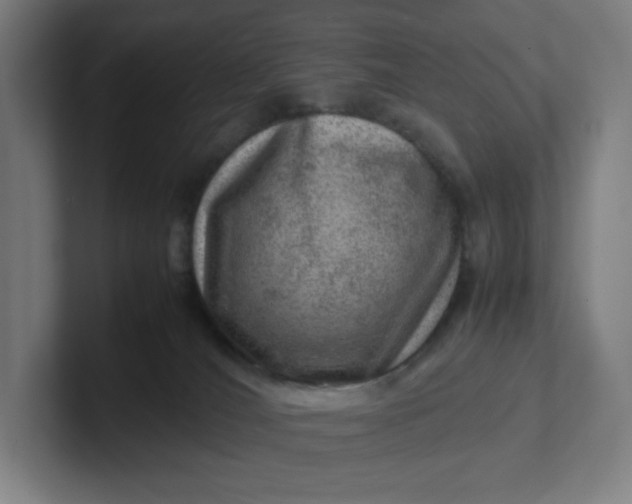 X0000102010036200808011152