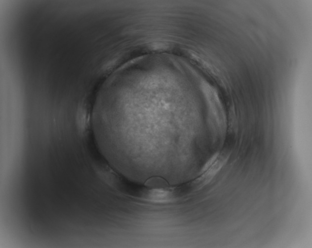 X0000102010176200808011150