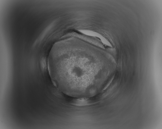 X0000102010335200808011148