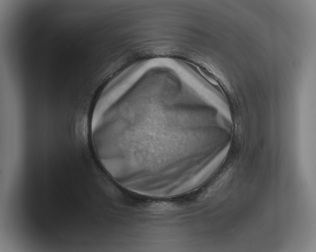 X0000102010397200808011147