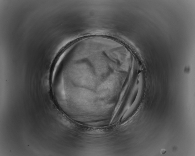 X0000102011174200808081717