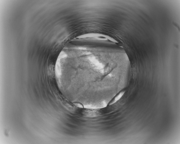 X0000102010093200808151302