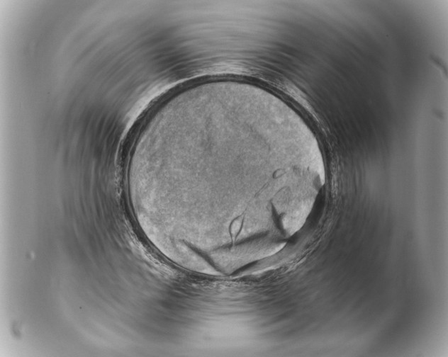 X0000102011116200808151245