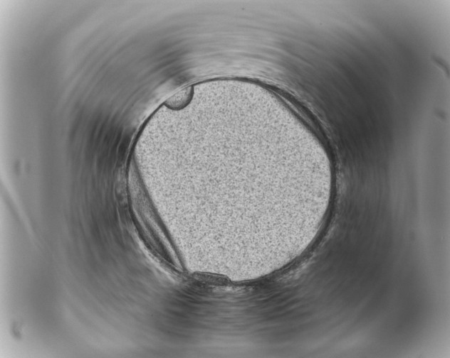 X0000102011521200808151239