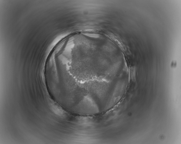 X0000102020147200808011432