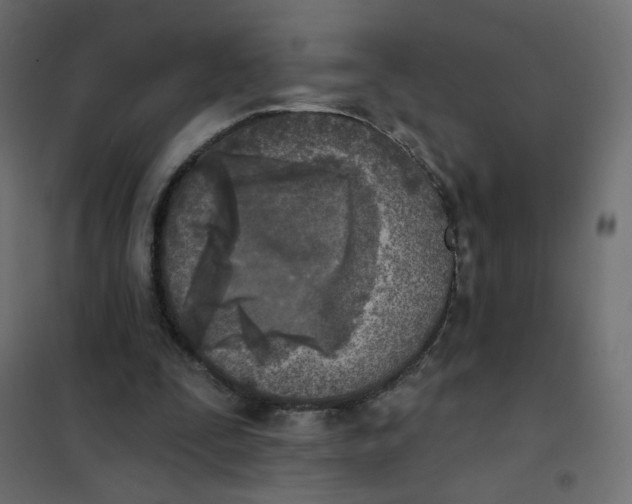 X0000102020295200808081755
