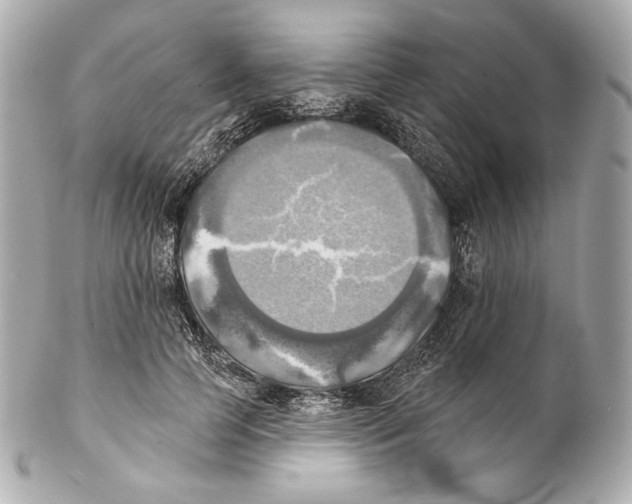 X0000102020745200808151315