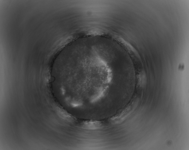 X0000102040517200808081838