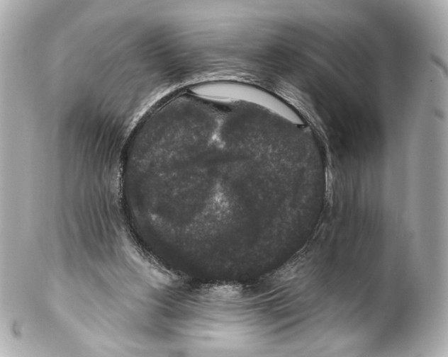 X0000102040156200808151414