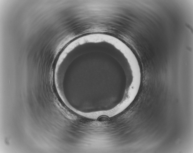 X0000102041179200808151400