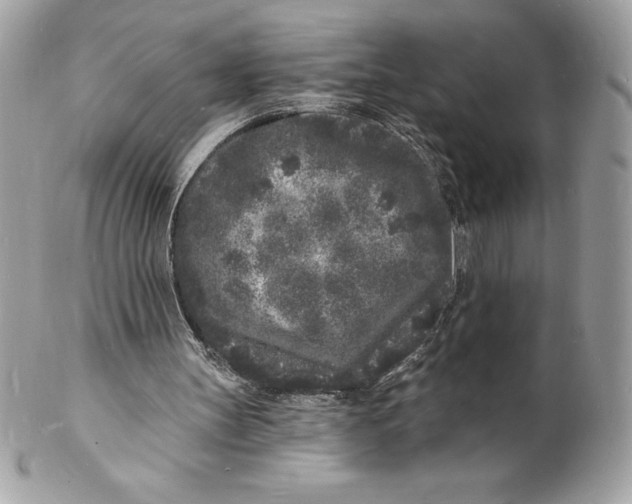 X0000102220147200808151714