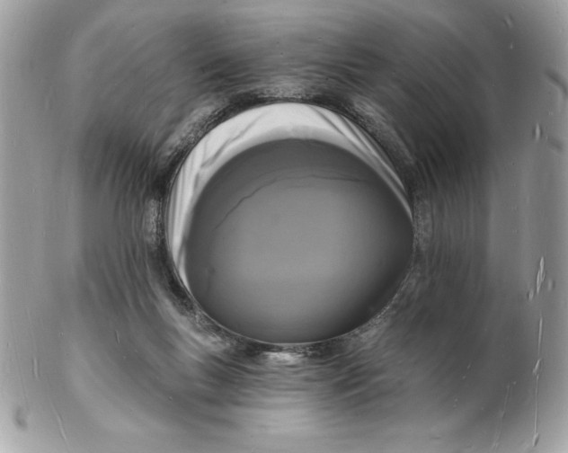 X0000102220167200808151714