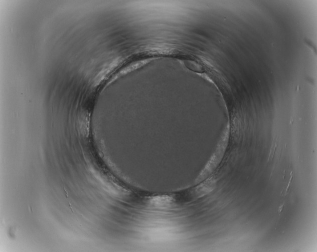 X0000102220168200808151714