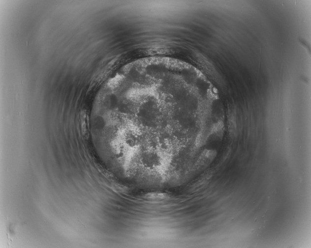 X0000102220169200808151714