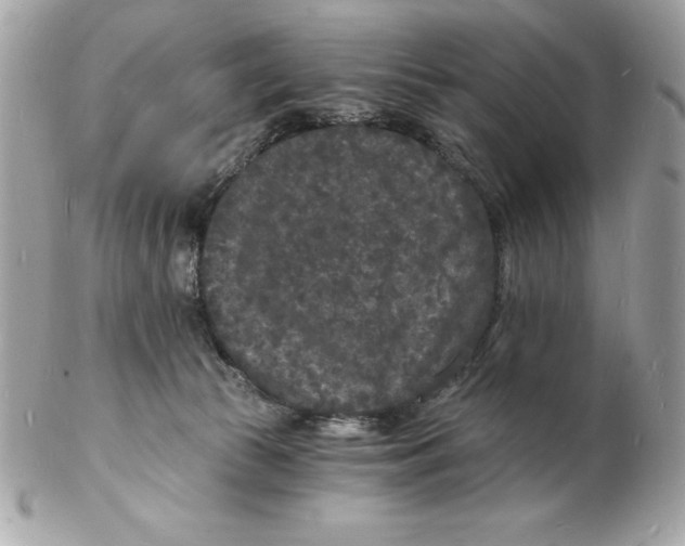 X0000102220177200808151714