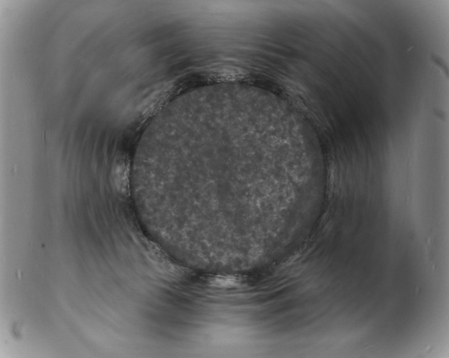 X0000102220177200808221254