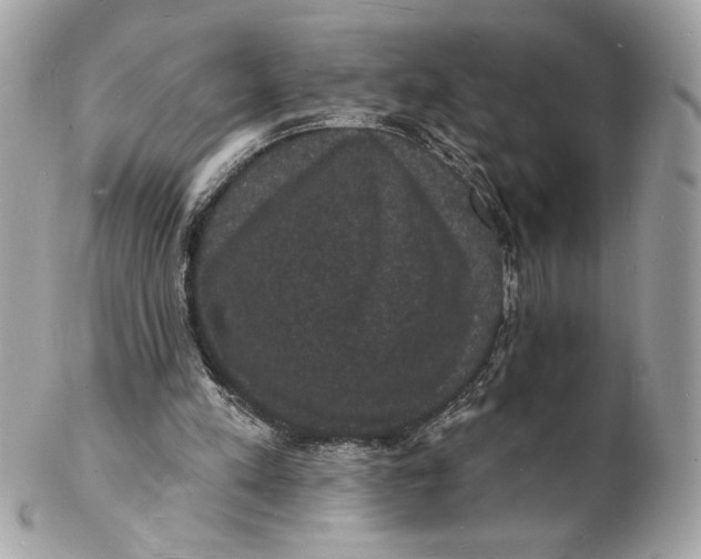 X0000102230197200808151738