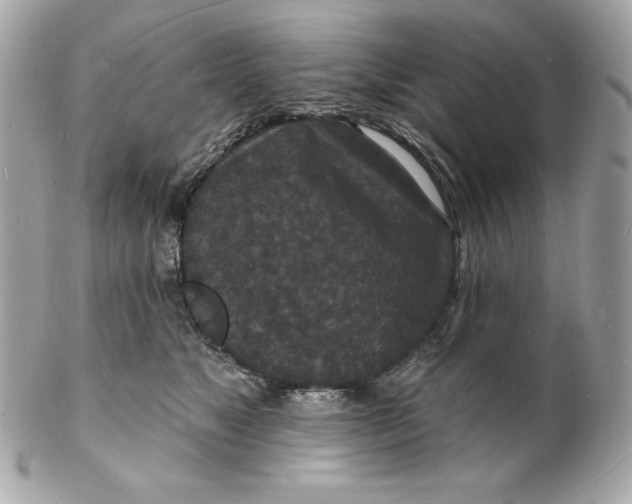 X0000102230517200808151733