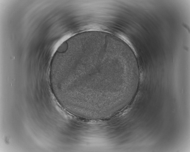 X0000102231146200808151723
