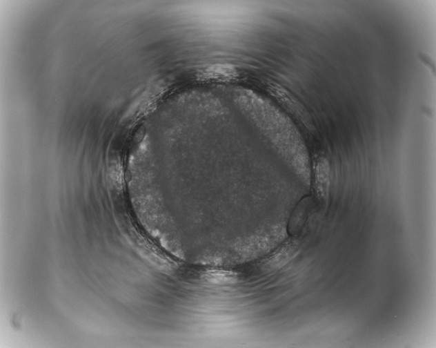 X0000102240617200808151755