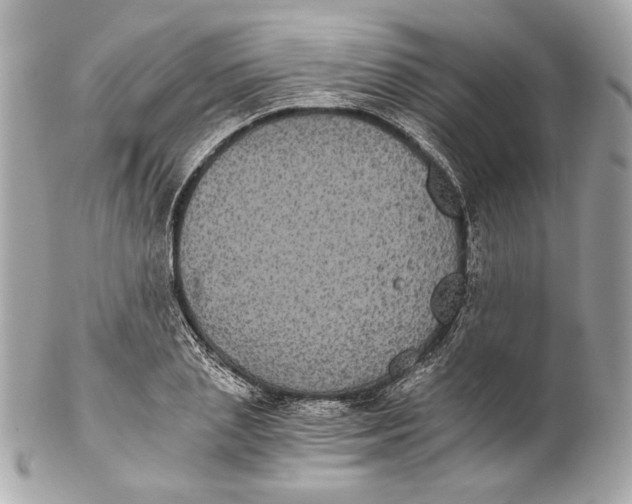 X0000102240837200808151752