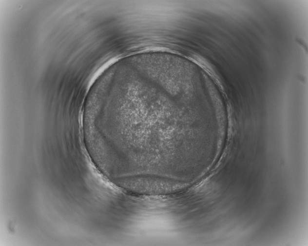 X0000102241198200808151746