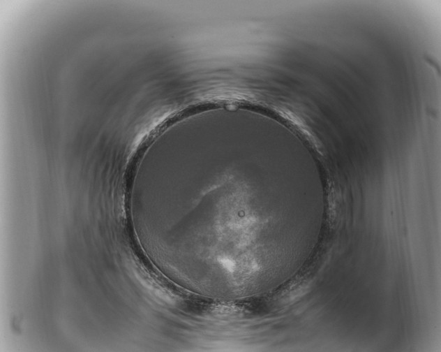 X0000102250399200808011315