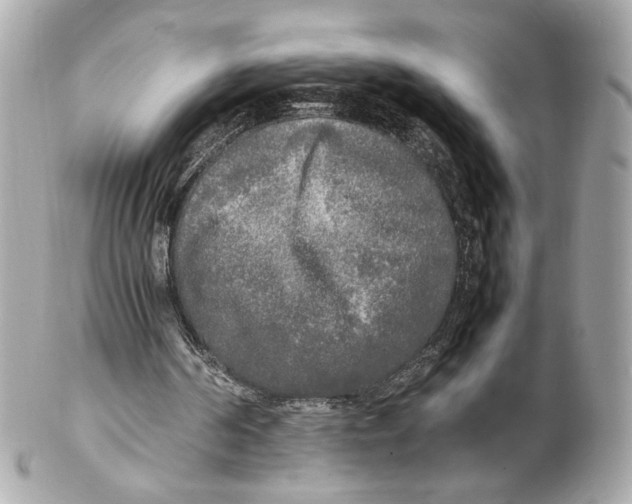 X0000102250194200808151825