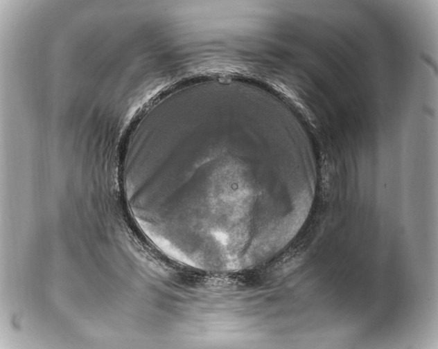 X0000102250399200808151822