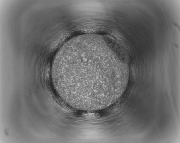 X0000102250499200808151820