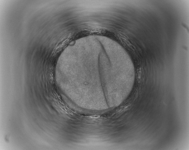 X0000102250916200808151813