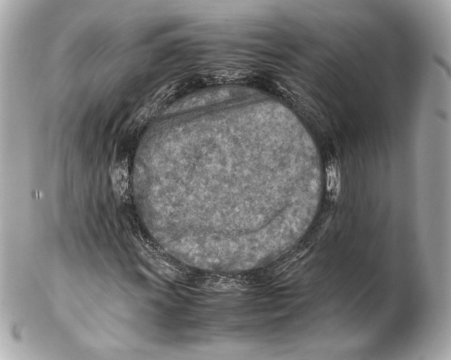 X0000102251011200808151812