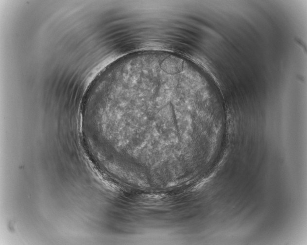 X0000102251125200808151811